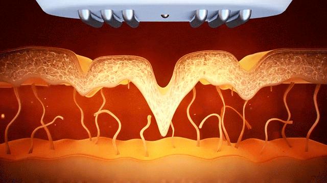 秋冬必备保湿补水神器,秋冬干燥保湿补水推荐