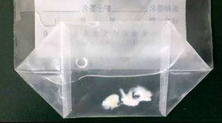 半月板缝合术后复查核磁还是撕裂,半月板缝合后拍磁共振还显示撕裂