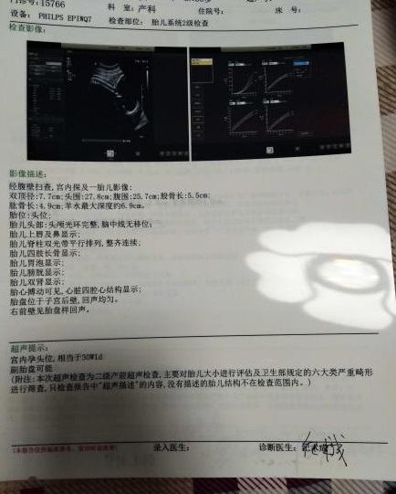 产检显示胎盘低很严重吗,有两个胎盘但是是单胎是什么原因
