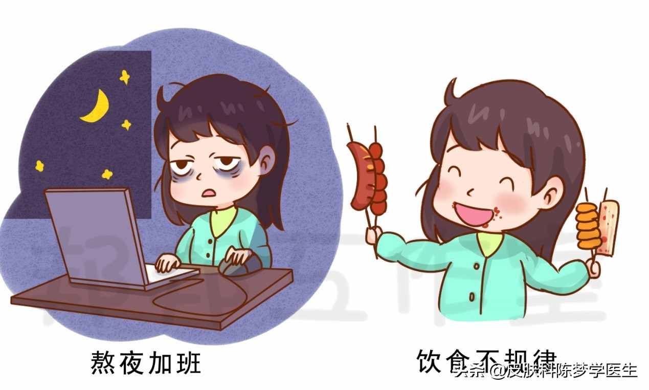 脸上爆发了严重的青春痘，这4种药物是首选