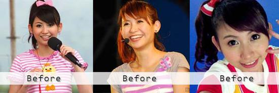 蝴蝶姐姐整容,蝴蝶姐姐整容原照