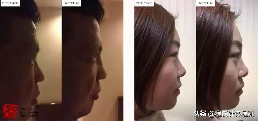 不要在脸上动任何刀,不要轻易在脸上动刀