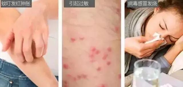 为何蚊子只咬你看完就明白了,蚊子咬人为什么越来越狠