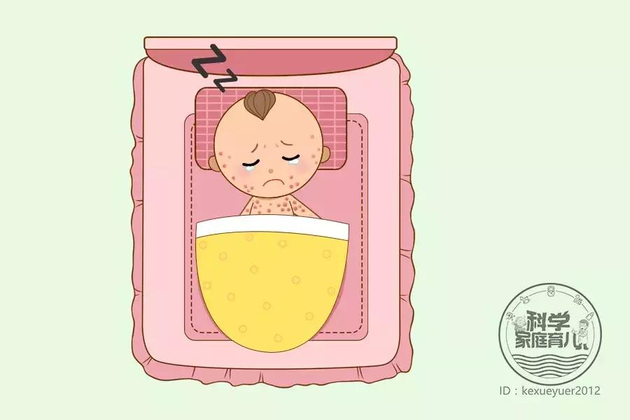 孩子全脸上身上长了疹子,小孩容易出现的各类疹子