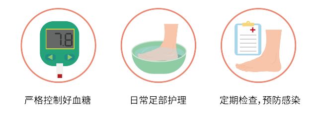 糖尿病足的痛苦,糖尿病足疼痛的不行怎么办