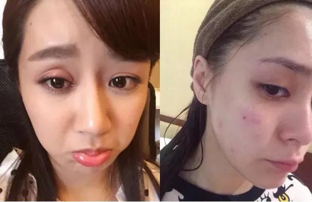 激光灭蚊神器制作,男子发明激光灭蚊子神器