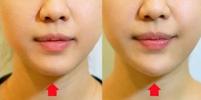 整成网红脸,为什么明星喜欢整成网红脸