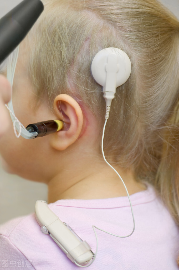助听器能代替耳蜗吗,重度听力配助听器还是人工耳蜗