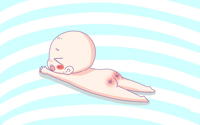 宝宝爱夹大腿一身汗,宝宝爱抠腿