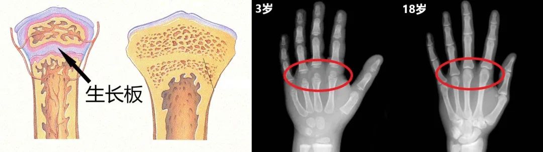 打篮球长高,练体操变矮?别逗了,你的身高早就被基因定好了