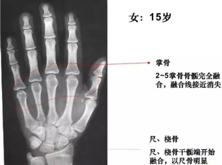 孩子个子高却跑不快,孩子个头不高怎么办