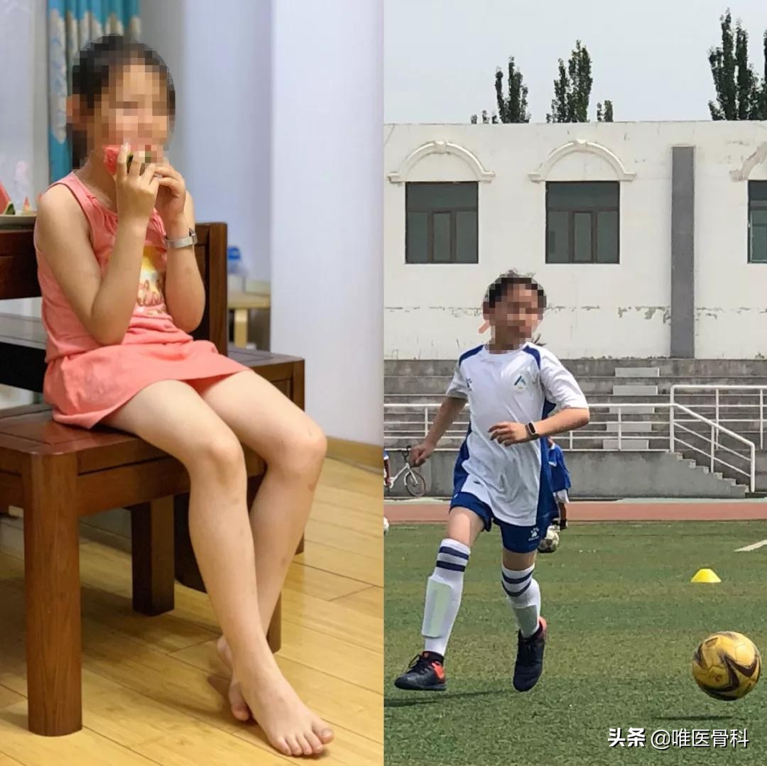 如何练成大长腿女神必看,如何练成又细又长的大长腿