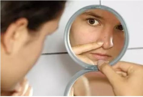 去黑头为什么黑头越来越多,长了黑头到底能不能挤