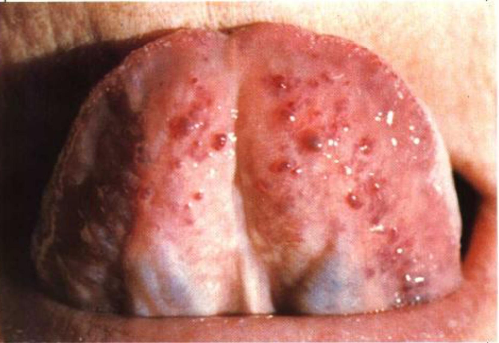 如何从舌苔判断健康,怎样通过舌苔颜色判断身体状况