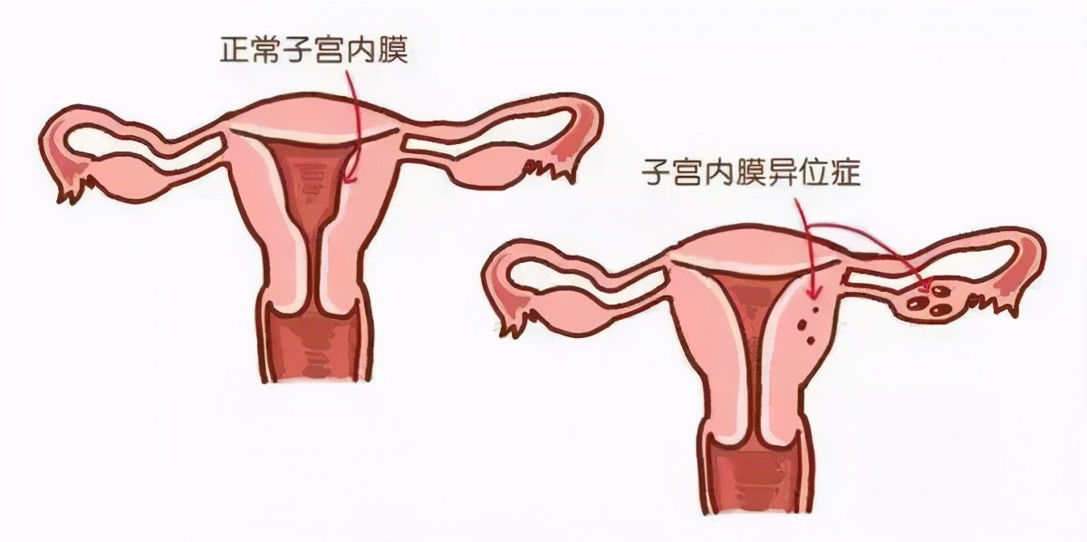 试管婴儿移植一个胚胎成功率高吗,试管婴儿移植失败下一步该怎么办