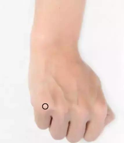 胡希恕经方治疗乳腺增生,中医治疗乳腺增生的处方