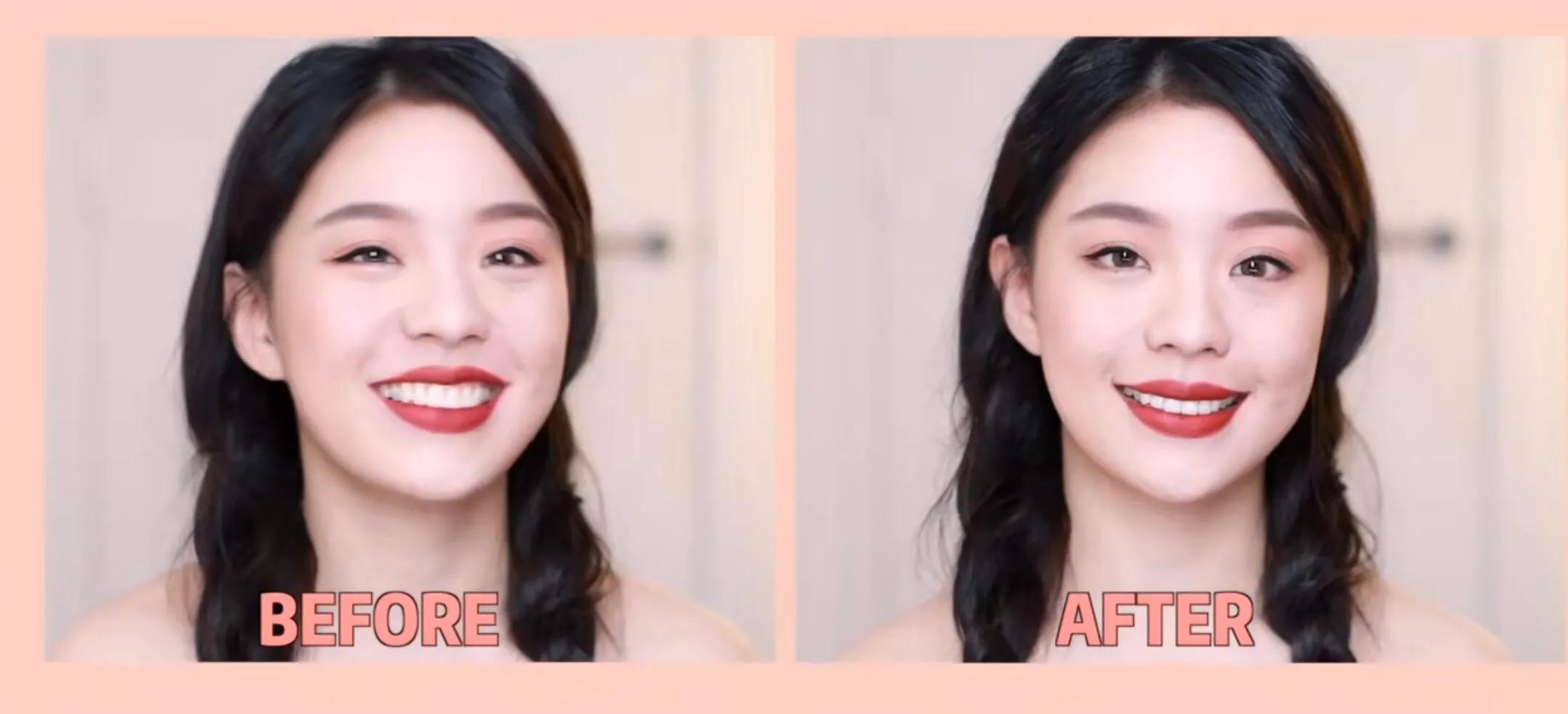 侧颜凸嘴怎么修,让侧脸变好看的方法