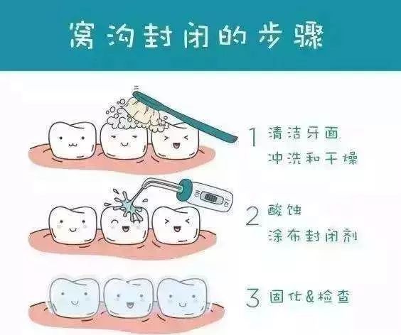 怎么样看牙最省钱,看牙嫌贵这个省钱机会千万别错过