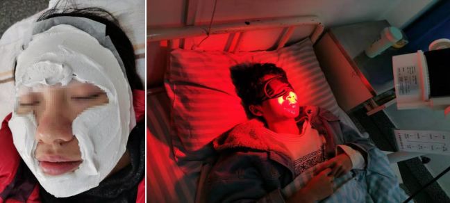 *疮痤**惹人恼，你了解多少？