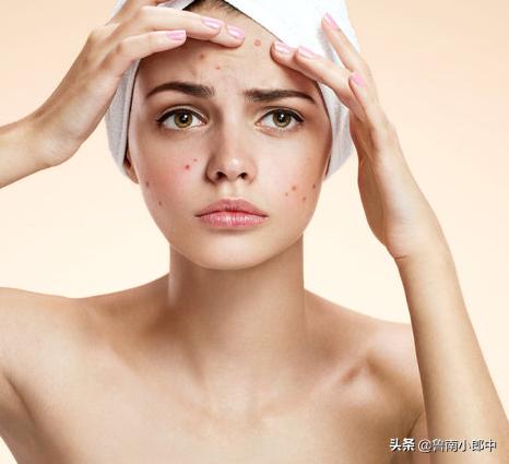 关于祛痘药膏你至少要知道这5款,7天快速祛痘原来便宜的才真有效
