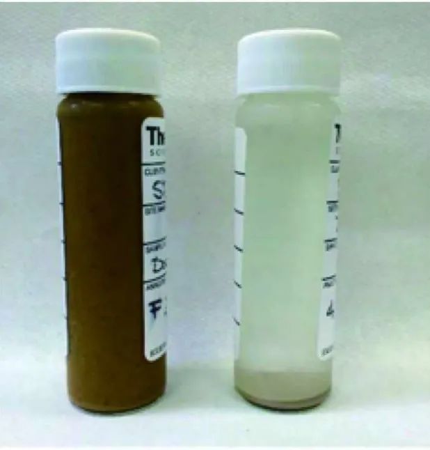 一人一年就产生近300斤粪便，全球70亿人的屎都去哪儿了？