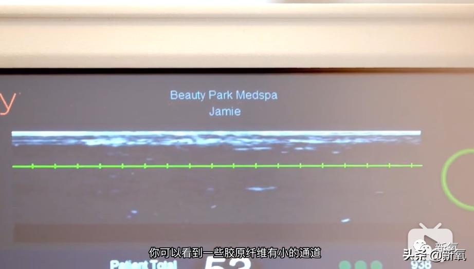 刘诗诗最近生图,刘诗诗旧照脸又胖又大