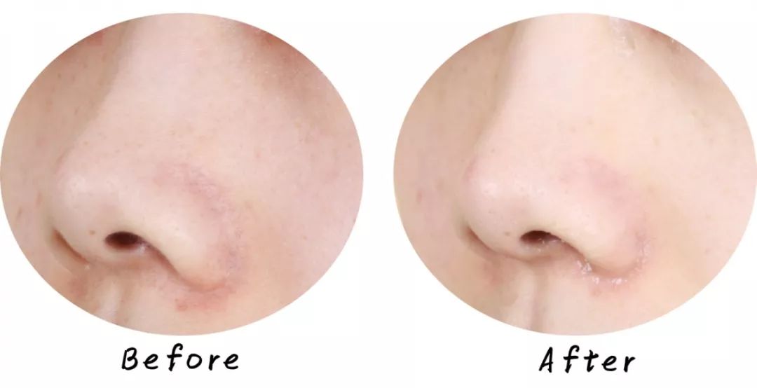 十大清洁面膜排行榜混合性皮肤,十大好用清洁面膜