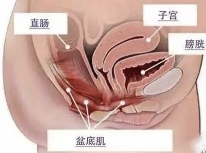 keep盆底肌修复运动训练,做盆底肌修复后流血是为什么