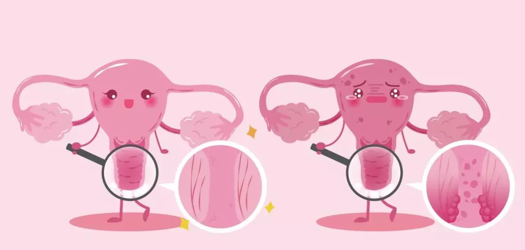 体检查了宫颈TCT，为什么还要做HPV，二者是否重复了？