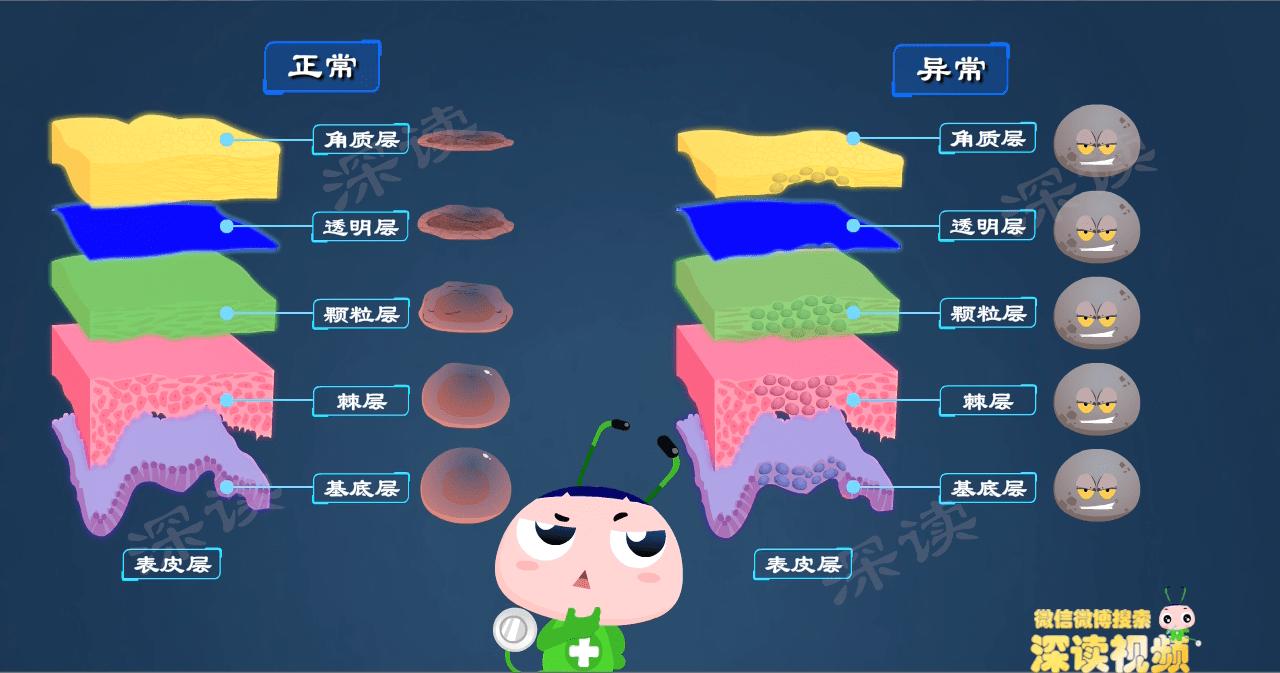 明明没出轨，为啥染上尖锐湿疣？*处私**咋就长出“菜花”了？