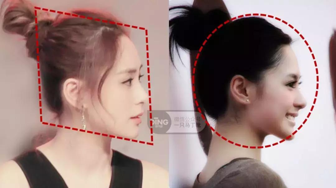 扁头有什么办法改善头型吗,扁头怎么让头变得饱满些