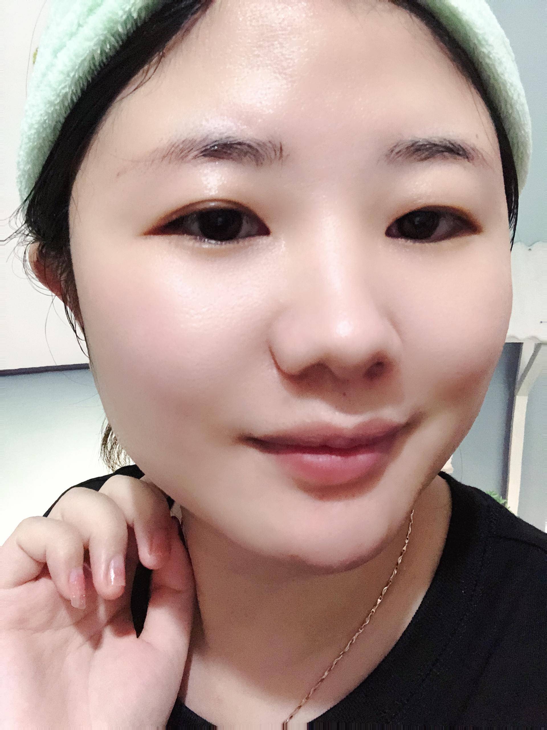 医用冷敷贴脸推荐,医用冷敷贴有补水的效果吗