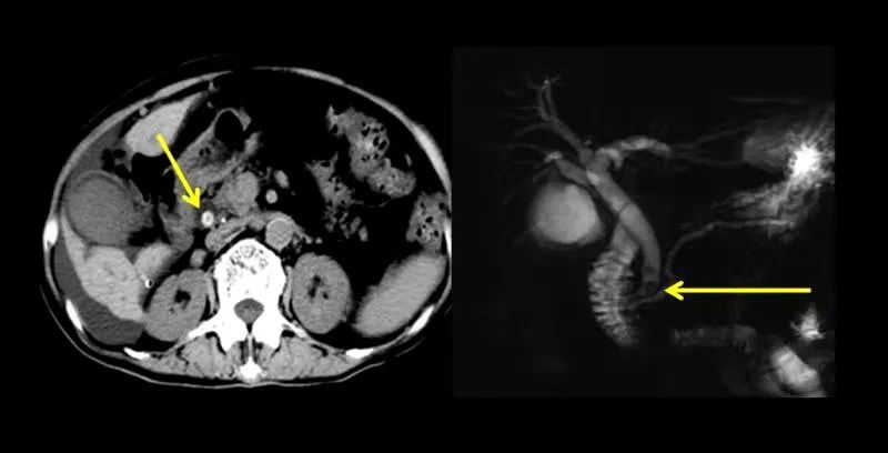 黄疸要做肝脾彩超吗,黄疸需要做颅脑彩超吗