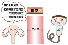 早孕期体检能查出来吗,怀孕第一次产检都是做阴超吗