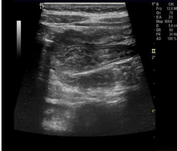 雨女无瓜的佛系带娃：孩子频繁呕吐要警惕！出现这一情况或要手术