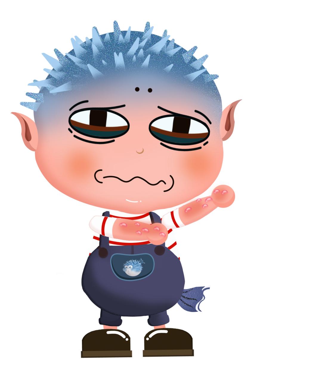 荨麻疹需要忌什么荨麻疹能自愈吗,麻疹处理流程