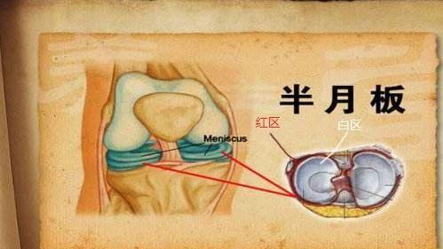 有关半月板的8个问题，给你最详细的解答