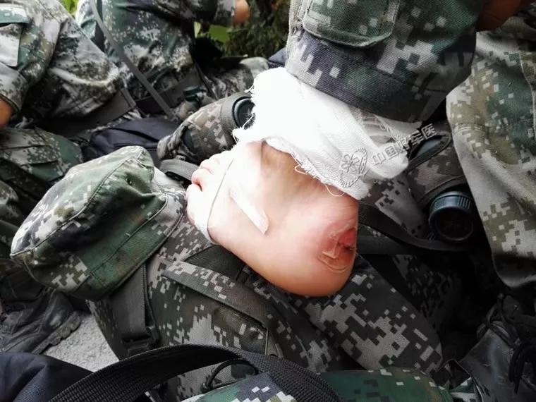 买鞋子尺码小了咋办,买鞋子尺码大小的讲究