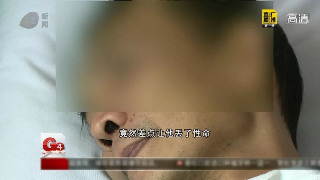 以为孩子只是平常的小感冒,男子发烧感冒确诊