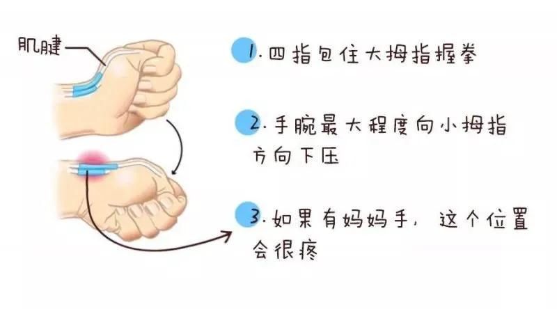 几大注意事项产妇要牢记,注意预防手麻疾病