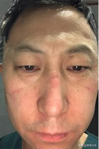 医师节抗疫英雄,疫情期间的医生护士英雄事迹