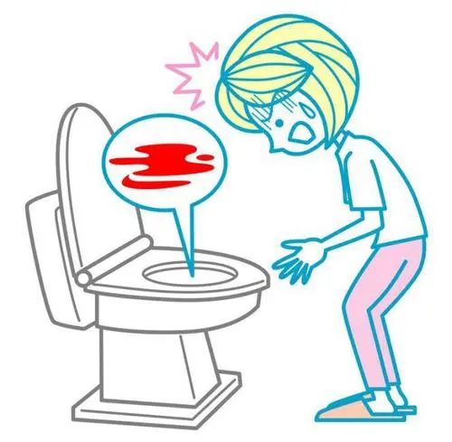 怎么知道肛裂有没有并发症,怎么知道肛裂有没有痊愈