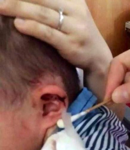 给三岁小男孩掏耳朵,3岁宝宝总是反复用手掏嗓子