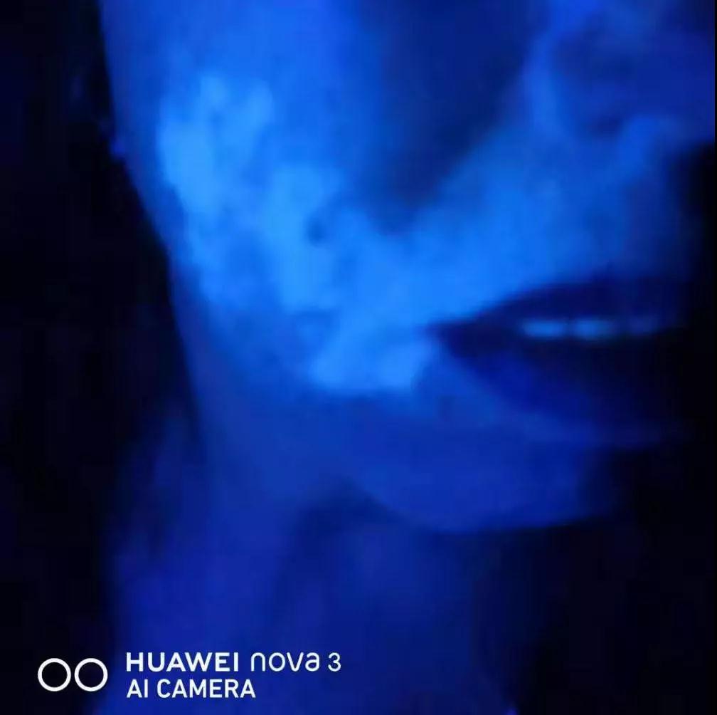 治疗白癜风中医好还是西医好,治疗白癜风中医好还是西医效果好