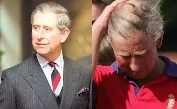 贝克汉姆秃了头,贝克汉姆秃了视频