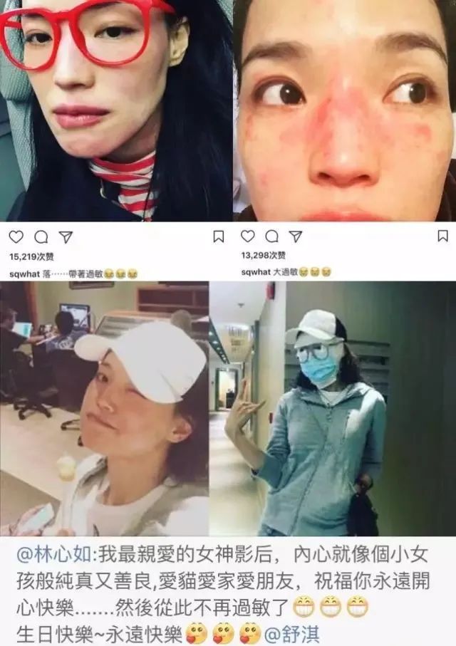 舒淇过敏都用什么护肤品呢,舒淇过敏化妆视频教程