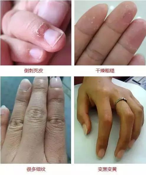 手干燥粗糙手纹深用什么护肤产品,可以改善手纹粗糙的护手霜