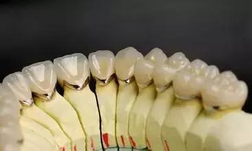 牙医怎么选科最好,牙医用什么材料补牙