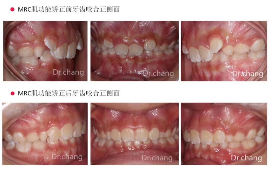 口腔医学医者仁心,口腔医学的工匠精神