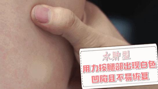 如何才能有一双长腿,如何拥有长腿